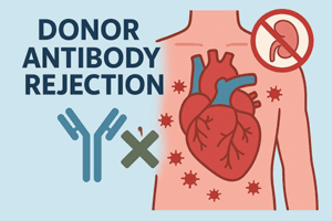 Donor antibody. rejection